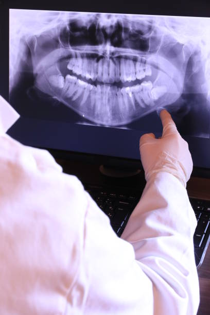 Best Emergency Root Canal Treatment in Roberta, GA