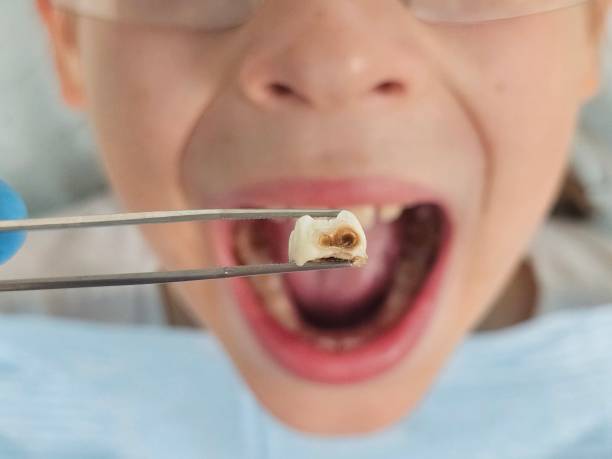 Best Same-Day Emergency Dentist in Roberta, GA