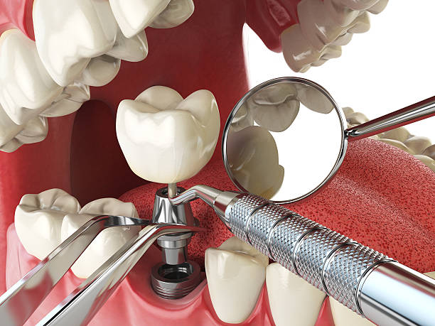Best Weekend Emergency Dentist in Roberta, GA